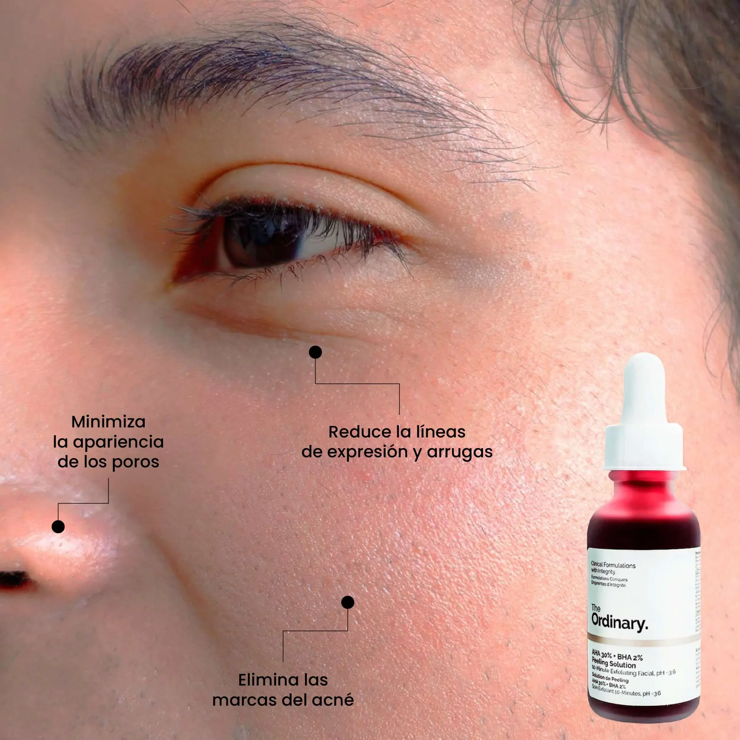T___SolucionPeelingAHA30_BHA2 (2).jpg__PID:dd5f533c-0d6d-447c-8382-5bbd08c8b5c3